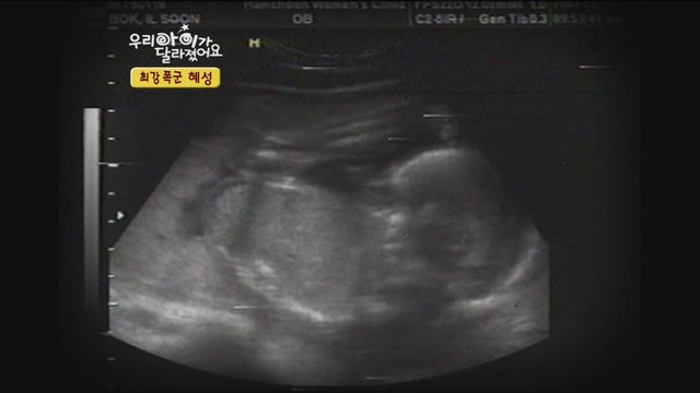 [우리아이가달라졌어요] 최강폭군 혜성이.jpg | 인스티즈