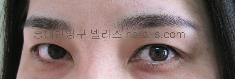 넬라스 이미지
