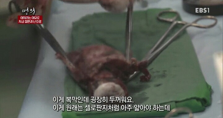 난소암은 정말 무서운 암입니다.jpg | 인스티즈