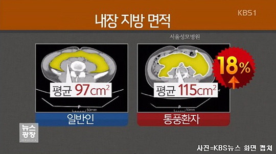 침묵의 암살자 뱃속의 시한폭탄 내장지방의 위험성 | 인스티즈