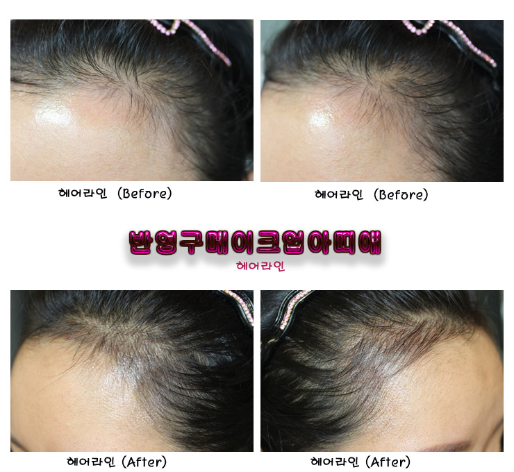 칼라헤어라인 이미지