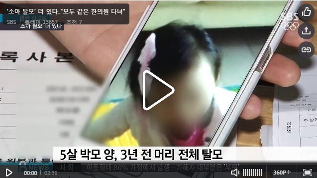 유명 어린이한의원 탈모한약사건 계기로 한약도 검증 필요하다 | 인스티즈