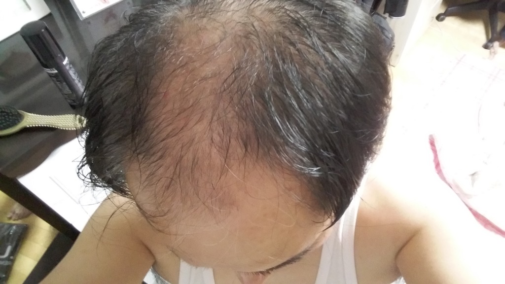 구지포스 이미지