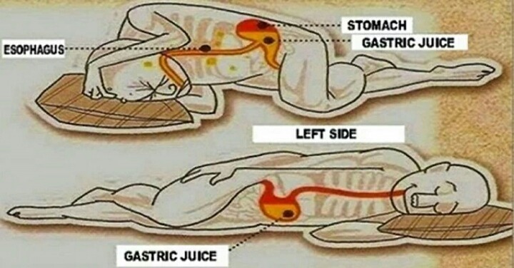 왼쪽으로 누워서 자야하는 이유 | 인스티즈