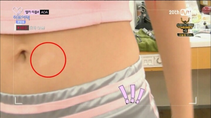 설현의 신체결점.JPG | 인스티즈