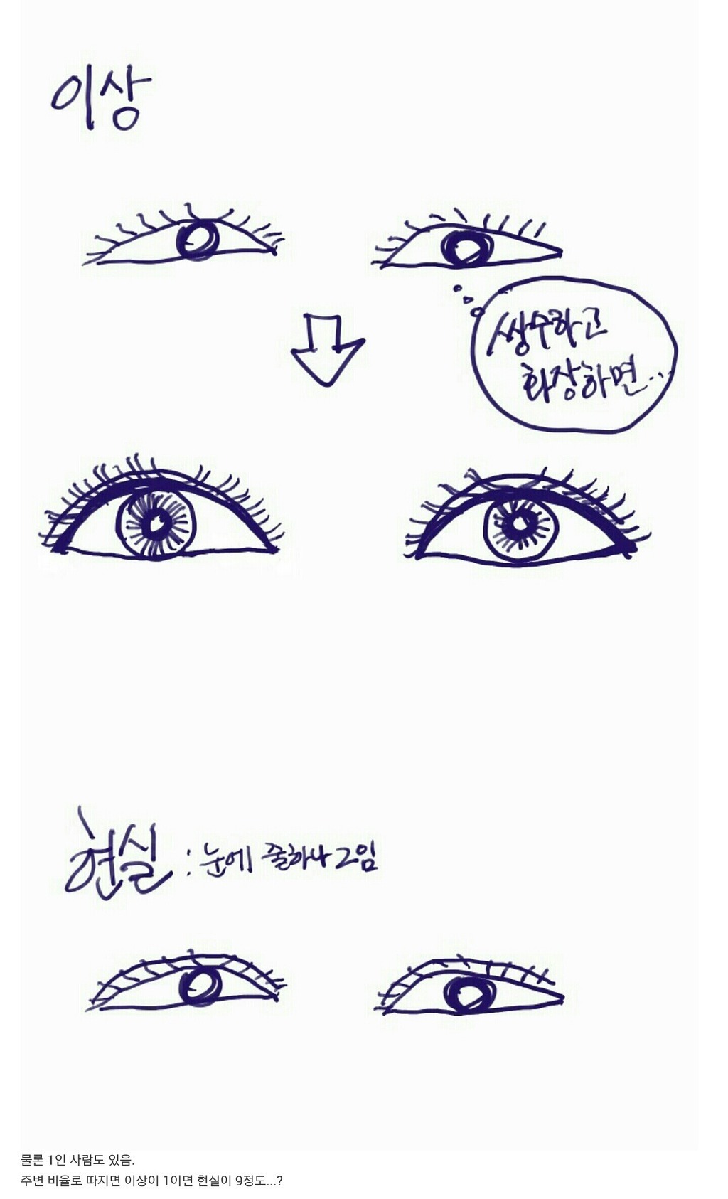 쌍커풀수술의 이상과 현실 | 인스티즈