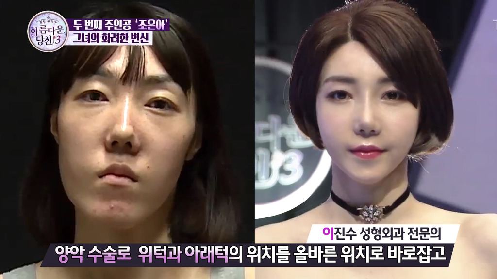 [렛미인역대급] 부정교합을 방치하면 안되는 이유 | 인스티즈